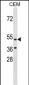 GPR109B Antibody (N-term)